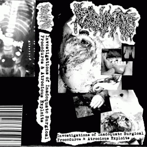 Fulminate : Investigations of Inadequate Surgical Procedures & Atrocious Exploits